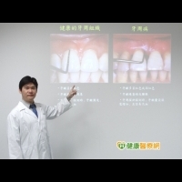 牙周病不治療　人工植牙成功率降二成