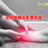 踩一步痛一步　 如何為足底筋膜炎解套？