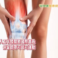 膝蓋痛吃藥、打針都無效 　置換人工半膝關節「彎更多」