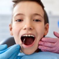 孩童牙亂齲齒生 減低蛀牙、牙周病發生率矯正可行