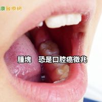 口腔腫塊導致嘴巴痛到張不開　拖到舌頭潰爛已太遲