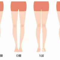 穿裙子顯瘦關鍵在「腿型」！穿搭視覺少3公斤詐欺術，首先要「認識腿型」