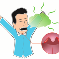 口臭不是牙周病，可能是「扁桃腺結石」惹的禍？如何檢查與改善？