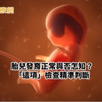 胎兒發育正常與否怎知？　「這項」檢查精準判斷