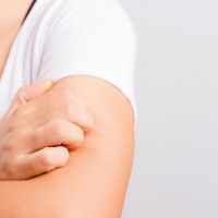 異位性皮膚炎易反覆發作 生物製劑療法健保放寬給付