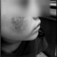 6歲童臉被老師用海綿刷到潰爛！媽媽反收幼兒園存證信函