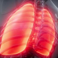 近30年肺癌發生率增3倍 除了受環境影響外還有這因素