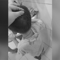 3歲兒撞破頭 媽媽控遭急診刁難