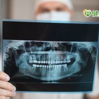 牙科拍攝X光輻射曝露恐害健康？　食藥署出面解析