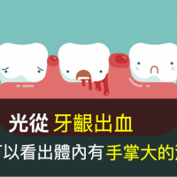 牙齦出血要小心！光從出血就可以看出體內有手掌大的潰瘍
