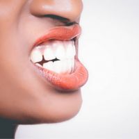 【有影】牙裂初期難診斷！類蛀牙病徵　重症患者恐植牙