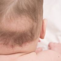 鬼剃頭脂漏性掉髮問題越來越多 中醫調理恢復頂上茂密