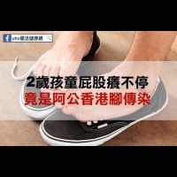 2歲孩童屁股癢不停　竟是阿公香港腳傳染