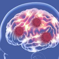 英國研究：新冠病毒不但可能傷肺　也可能傷腦
