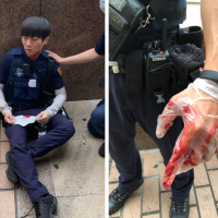 「無罩」街友被檢舉　不滿盤查揮刀砍傷警