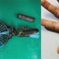 行動電風扇鋰電池突爆炸 學生手掌燒燙傷