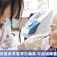 台灣拔除與放置鼻胃管率仍偏高 可由訓練重建吞嚥功能