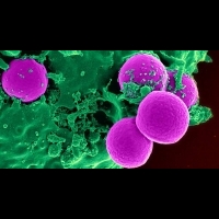 【超級細菌】21世紀健康危機 尋找抗生素接班人 | 健康達人網