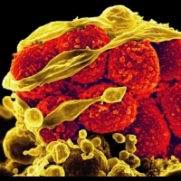 抗生素接班人「奈米粒子」助攻 超級金黃色葡萄球菌完敗 | 健康達人網