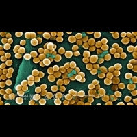 美首度發現抗藥性超級金黃色葡萄球菌侵入血液 | 健康達人網