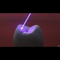 再生醫學大突破 雷射光能修復牙齒！ | 健康達人網