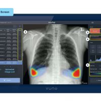 承業生醫獨家經銷韓國VUNO人工智慧快速判讀胸部X光軟體，取得歐盟CE、韓國KFDA及國內TFDA三重認證