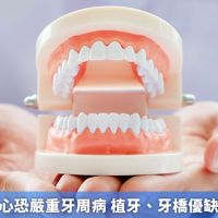 缺牙不補小心恐嚴重牙周病 植牙、牙橋優缺點完整解析