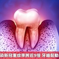 牙周病患感染新冠重症率將近9倍 牙齒鬆動恐為時已晚