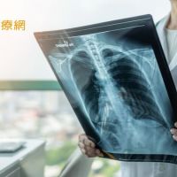 莫名喘咳竟是晚期小細胞肺癌　免疫組合治療燃生機