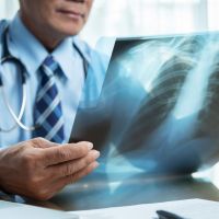 肺癌提早發現？ AI能偵測肺結節？ 國泰醫院3000例實測：準確度有望破9成