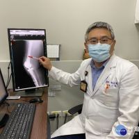 治療人工關節感染勞心勞力 醫師說最新觀念讓病人省時省力