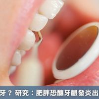 胖子容易掉牙? 研究:肥胖恐釀牙齦發炎出現掉牙危機