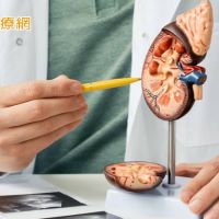 自然孔道無創腎內手術　腎臟囊泡、腫瘤、結石治療新利器