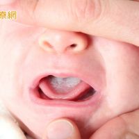 寶寶嘴巴出現白點或血點 小心念珠菌感染引發「鵝口瘡」
