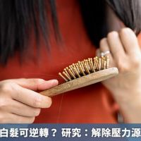 壓力引起的白髮可逆轉? 研究:解除壓力源不需染頭髮