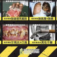 菸盒警示圖文修法放大85％！ 國健署要靠「噁圖」嚇民眾戒菸