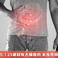 大腸癌年輕化!25歲就有大腸瘜肉 未及早揪出恐釀成癌