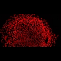 核轉殖幹細胞比諾貝爾獎幹細胞更有用？ | 健康達人網