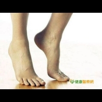 腳趾間脫皮　小心是香港腳徵兆