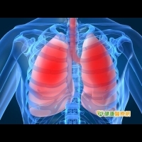 肺癌覺察不易　定期檢查及早治療