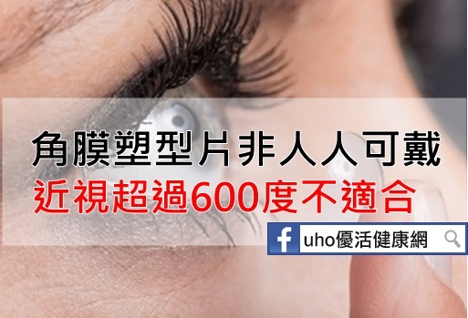 角膜塑型片非人人可戴　近視超過600度不適合