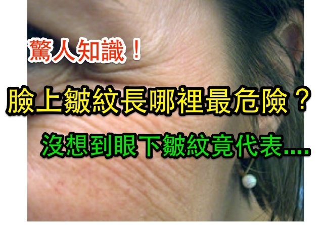 臉上皺紋長哪裡最危險？沒想到眼下皺紋竟代表....